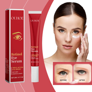 Moisturizing Eye Cream